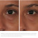Лифтинговый крем-гель для век ORMEDIC balancing eye lift gel Лифтинговый крем-гель для век ORMEDIC balancing eye lift gel