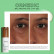 Лифтинговый крем-гель для век ORMEDIC balancing eye lift gel Лифтинговый крем-гель для век ORMEDIC balancing eye lift gel